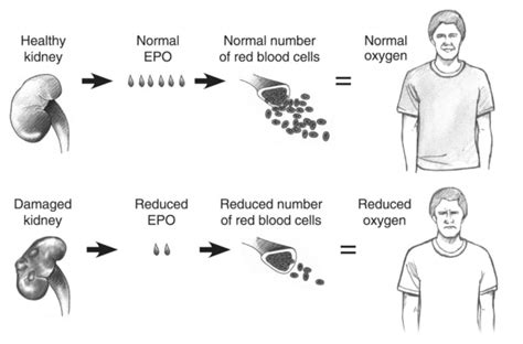 Reduced red blood cell production versus normal production | Media ...