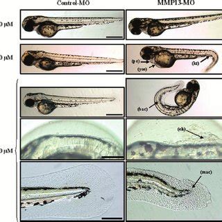 MMP 13 Expression Is Required For Normal Zebra Fish Development