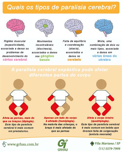 GRHAU Therasuit Quais Os Tipos De Paralisia Cerebral