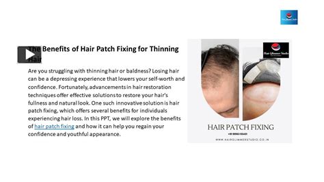 Ppt The Benefits Of Hair Patch Fixing For Thinning Hair Powerpoint