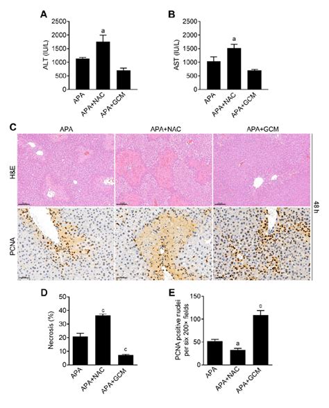 Prolonged Treatment With Glycycoumarin Gcm Facilitates Liver Recovery