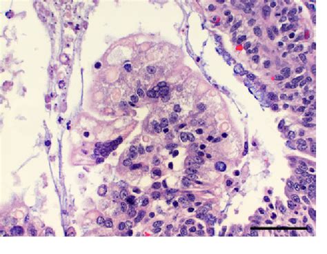 Porcine epidemic diarrhea virus | Semantic Scholar