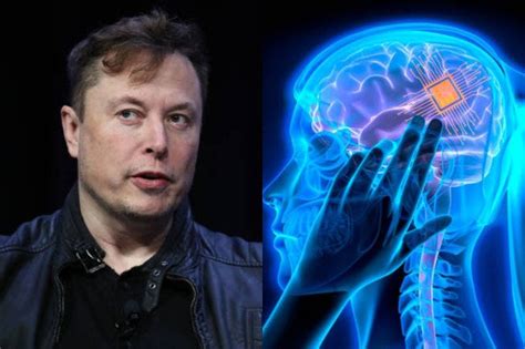 Neuralink La Propuesta De Elon Musk Para Instalar Chips En El Cerebro