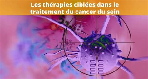 Thérapies Ciblées Du Cancer Du Sein Les Nouveaux Traitements