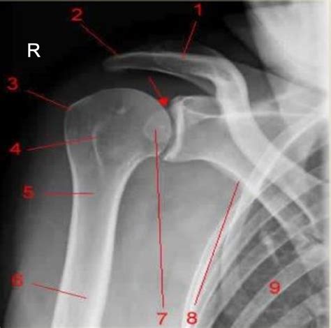 Diagram Of Positioning And Projections Of The Shoulder Girdle Quizlet