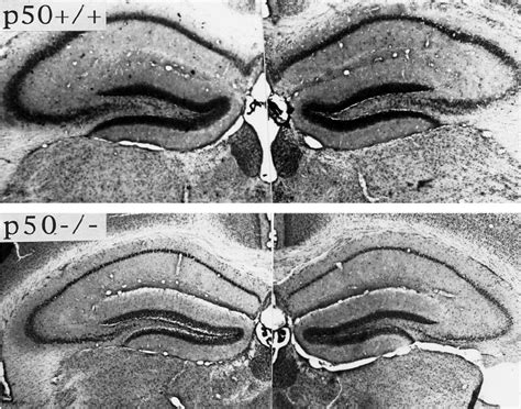 Cresyl violet stained sections of hippocampi from p50 ϩ ϩ top and