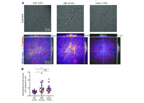 In Vitro Infection Experiments Validate The Computational Finding Of