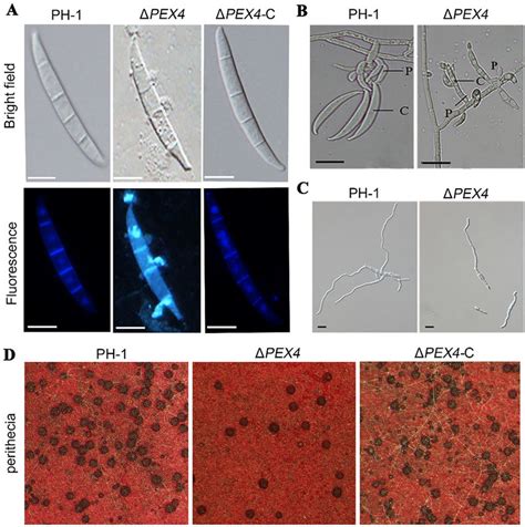 The Pex Mutant Exhibited Defects In Conidial Morphology