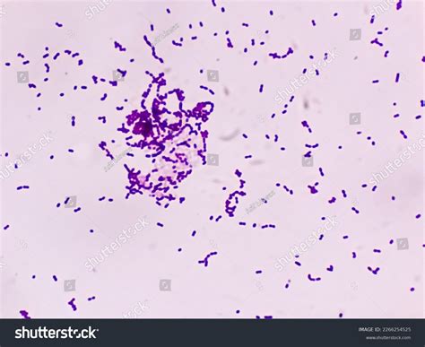 Klebsiella Pneumoniae Gram Stain Photos, Images and Pictures