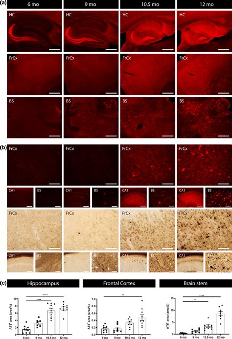 Progressive Tau Pathology In Tau P S Mice A Representative Images Of