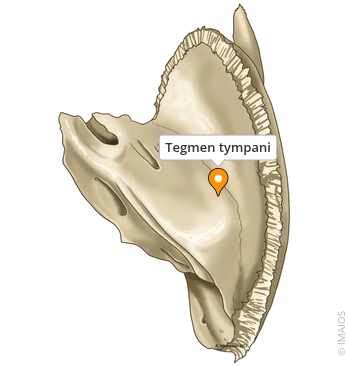 Tegmen tympani - e-Anatomy - IMAIOS