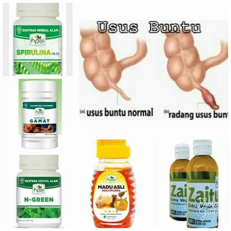 Jual Paket Obat RADANG USUS BUNTU Obat Herbal HPAI Indonesia Shopee