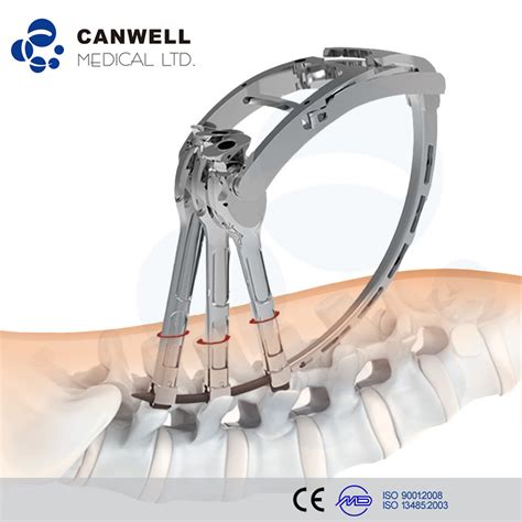 Canwell Minimally Invasive Spine Instrument Set Mis System Spinal Instrument Cannulated