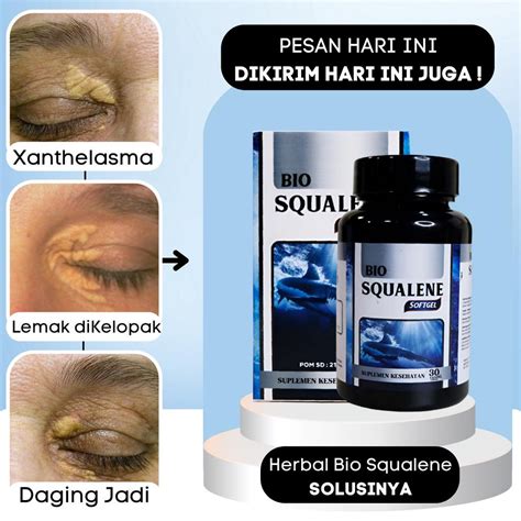 Jual Obat Xanthelasma Gumpalan Lemak Di Kelopak Mata Obat Penghilang