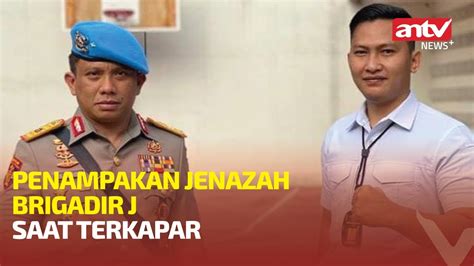 Komnas Ham Bongkar Foto Jenazah Brigadir J Saat Terkapar Antv News