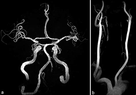 Surgical Neurology International