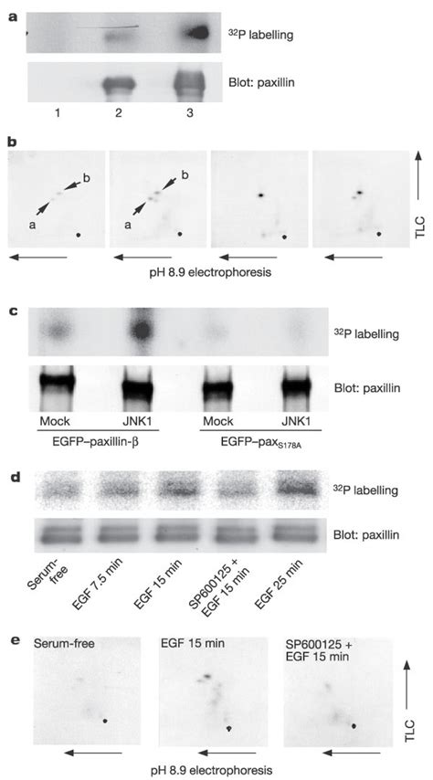 Paxillin Is Also Phosphorylated At Ser 178 In Cells A Overexpression