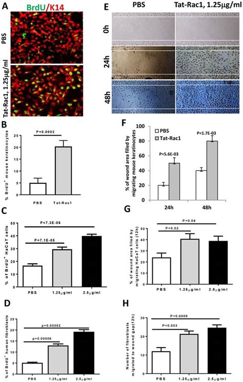 Topical Application Of Tat Rac1 Promotes Cutaneous Wound Healing In