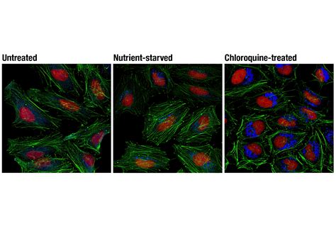 Lc3a B D3u4c Xp® Rabbit Mab Alexa Fluor® 647 Conjugate Cell Signaling Technology