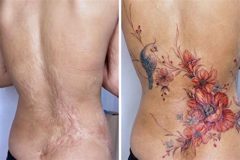 50 Times People Asked To Cover Up Their Scars And This Tattoo Artist