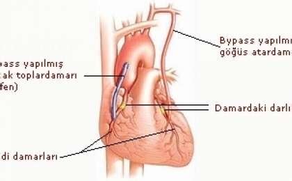 Bypass Ameliyatı Prof Dr Mustafa Güler