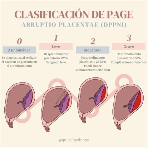 Bianca Palomares On Instagram Desprendimiento Prematuro De Placenta