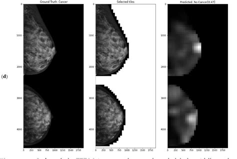 Figure 11 From Attention Based Deep Learning System For Classification