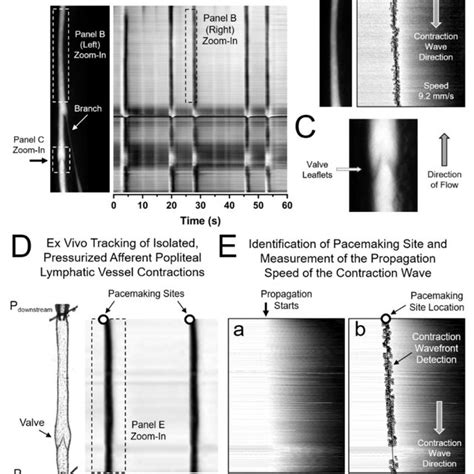 Ex Vivo And In Vivo Assessment Of The Contractile Function Of Lymphatic