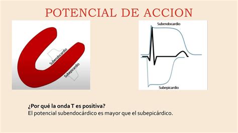 Cardiopatía Isquemica definicion diagnostico y tratamiento pptx