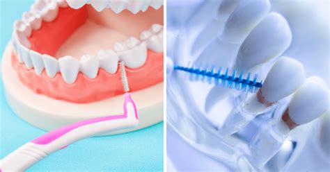 C Mo Usar Los Cepillos Interdentales Como Un Profesional Cl Nica Dr Viso