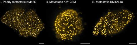 Clathrin Topology Imaged With Confocal Fluorescence Microscopy