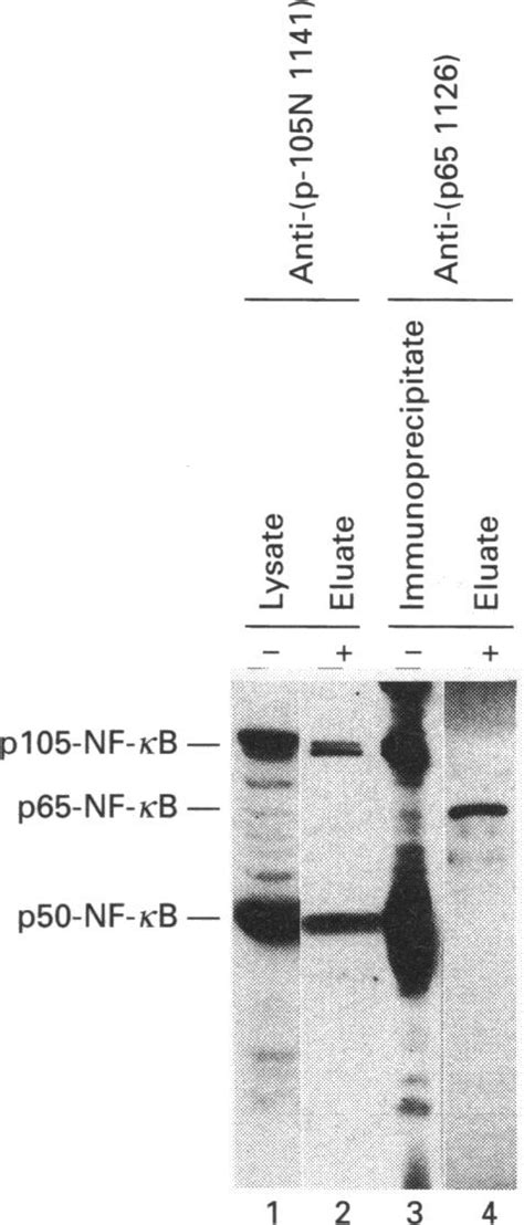 Identificaton Of The C Rel Associated Kda Protein As P Nf Kb