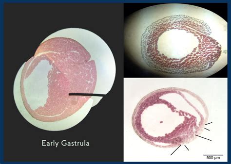 BIO22LAB.4 Early Gastrula Diagram | Quizlet