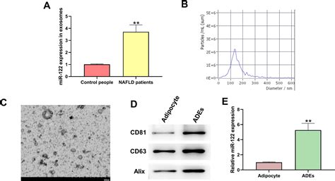 Adipocytes Derived Exosomal Mir 122 Promotes Non Alcoholic Fat Liver