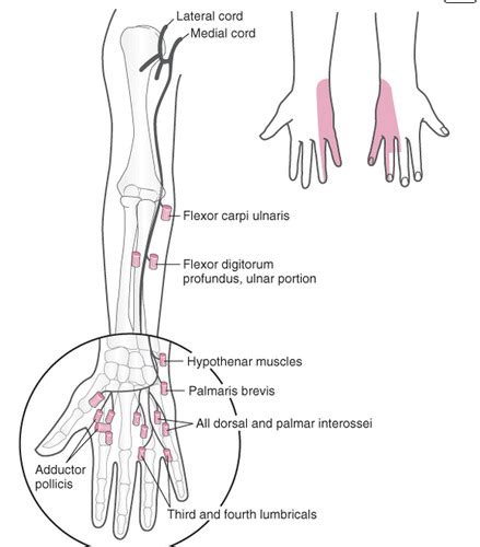 Forearm Wrist Hand Lecture Flashcards Quizlet