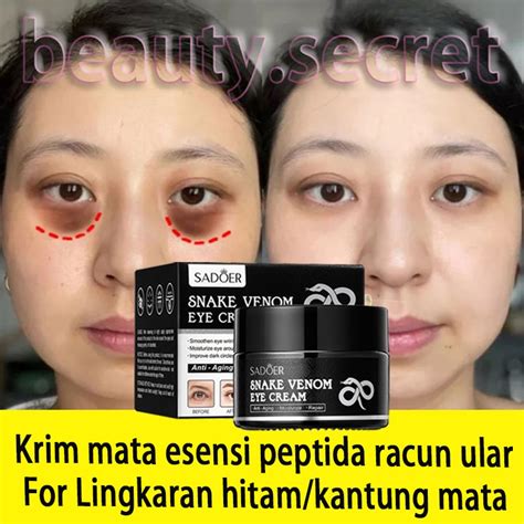 Jual Cream Mata Bisa Ular Untuk Krim Kantung Mata Panda G Mengurangi