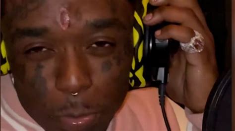 This Rapper Got A 24m Diamond Embedded In His Forehead Cnn