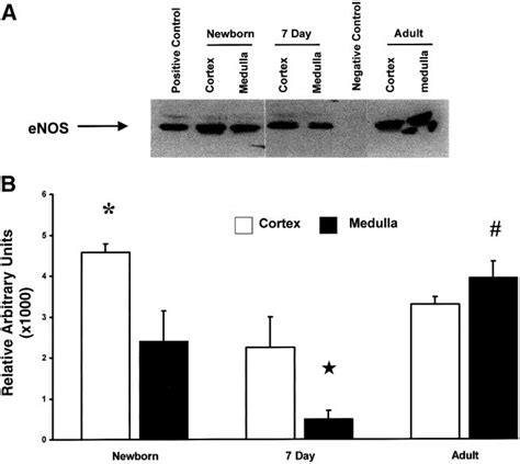 Western Blot Determination Of Enos 135 Kda Protein Content In The Download Scientific Diagram