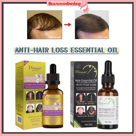 Disaar Anti Hair Loss Hair Essential Oil Menggurangkan Rambut Gugur