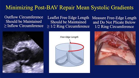 Internal Aortic Annuloplasty Remodeling Ring In Bicuspid Aortic Valve Repair Different