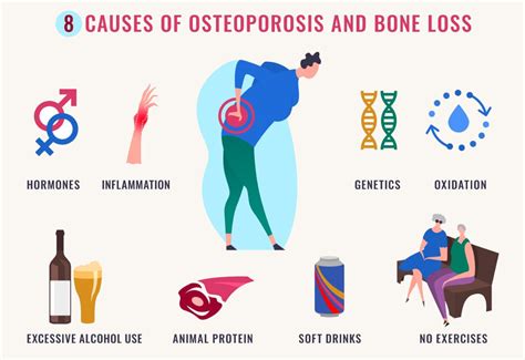 Osteoporosis Ukts