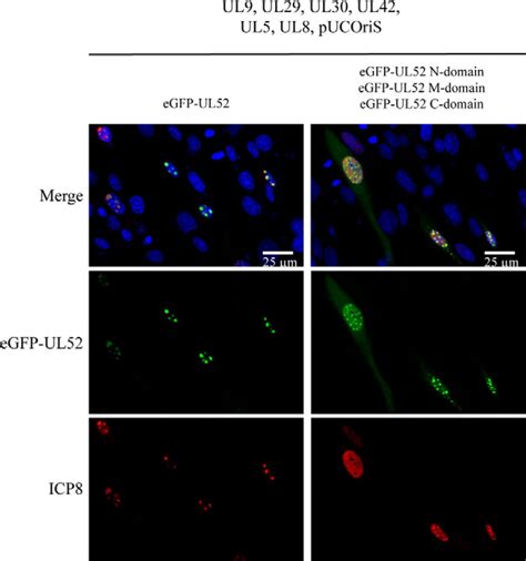 UL52 Primase Interactions In The Herpes Simplex Virus 1 Helicase