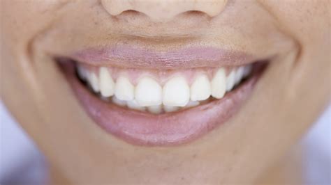 Natural Teeth Whiteners