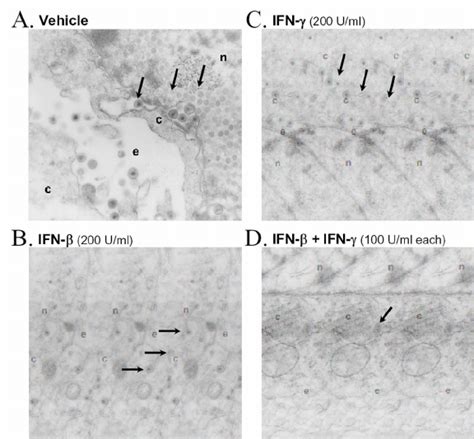 Effect of IFN β and IFN γ on virion formation in HSV 1 infected cells