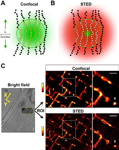 Imaging Of Intracellular TT Membrane Structures By Confocal Versus STED