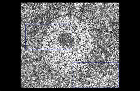 Hls Ultrastructure Of The Cell Nucleus And Cytoplasm Low Mag