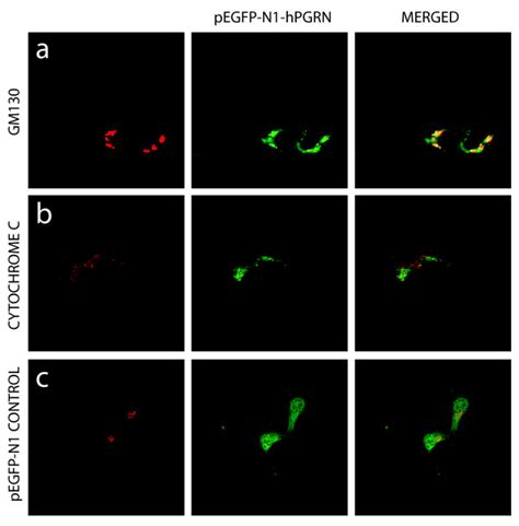 Transfection Of Pegfp N1 Hpgrn Plasmid Shows Granular Morphology And