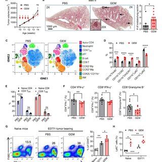 Gemcitabine Chemotherapy Promotes Breast Cancer Lung Metastasis And