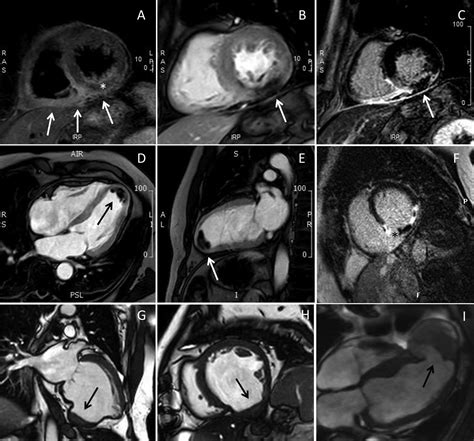 Cardiovascular Magnetic Resonance Imaging What The General