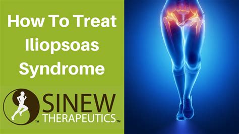 How To Treat Iliopsoas Syndrome And Speed Recovery Youtube